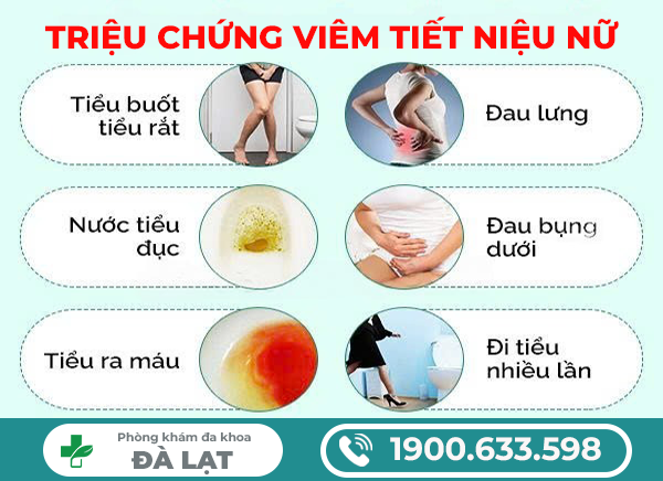 Hình ảnh minh họa